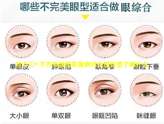 对 🌺 于方形脸整形案例对比图你想了解什么